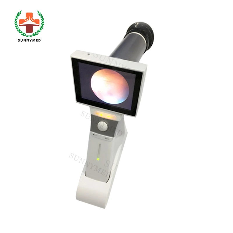 Sy-V042 Hot Sale Ophthalmic Digital Portable Eye Fundus Camera