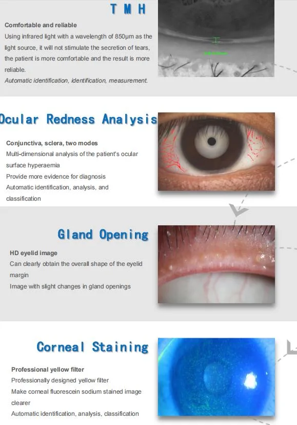 Ophthalmology Ocular Surface Analyzer Optical Instruments for Eye Hospital